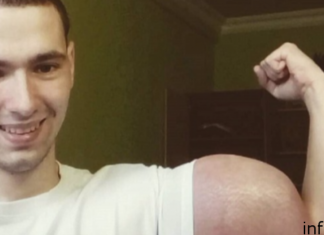 : Руки-базуки Кирилл Терешин: свежие фото, Инстаграм, очередная операция, что будет делать, трансформация Терешина