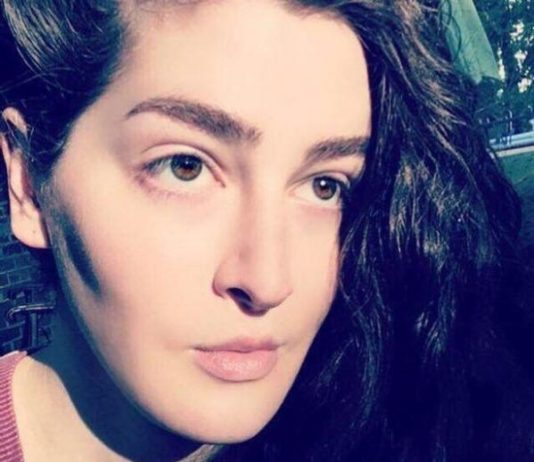 Женщина потратила 12 млн на пластику, чтобы измениться до неузнаваемости из-за издевательств в школе